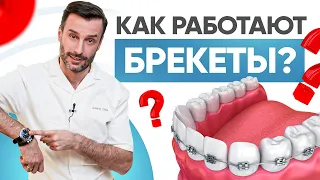 Как работают брекеты и почему так медленно? Современная ортодонтия