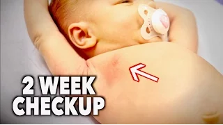 Newborn Has Breast Tissue & Milk Production (IS THAT NORMAL?) | 2 week check after birth | Dr. Paul