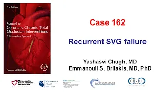 Case 162: Manual of CTO PCI - Recurrent SVG failure