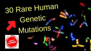 Probability Comparison: 30 Rare Human Genetic Mutations