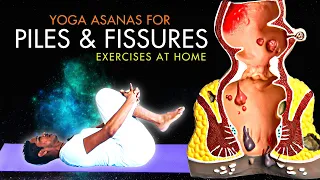 Piles Problem Treatment | Yoga for Piles and Fissures | Best Piles Exercise at Home