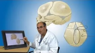 Craniosynostosis and its treatment | Boston Children’s Hospital