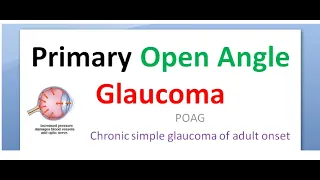 Ophthalmology 236 a Primary Open Angle Glaucoma POAG Symptom Classification risk factor Diurnal test