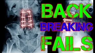 Epic Fail Compilation - Incredible Back Breaking Videos