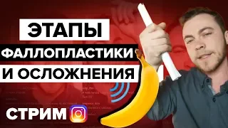 🔴 Возможные Осложнения при Фаллопластике [Инстаграм Стрим 24.04.2019 @dima_t_time]