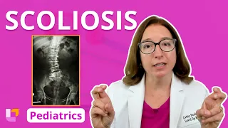 Scoliosis: Musculoskeletal System - Pediatric Nursing | @LevelUpRN Delete.​
