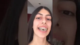 They Put WHAT On Her Braces?!