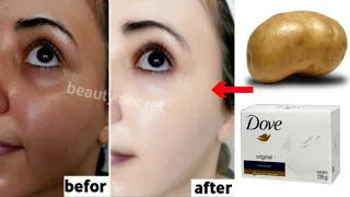 Potatoes and soap,A japanese secret to whitening the skin 10 shades and removing pigmentation