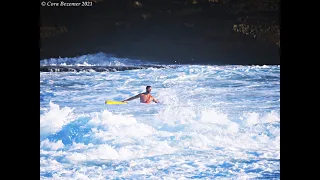 Lifeguard Anthony Glick rescuing surfer - notorious Tamarama & Bronte Beaches - By Cora Bezemer