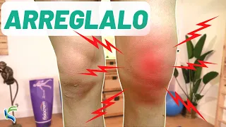 Swollen and swollen knees? 👉 5 EXERCISES to DEFLAMATE 🤩 Fisiolution