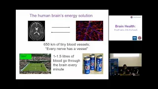 Brain Health - a small matter of the blood vessels