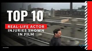 Top 10 Real-Life Actor Injuries Shown on Film