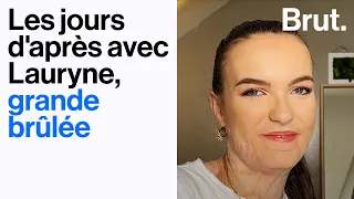 Les jours d'après avec Lauryne, grande brûlée