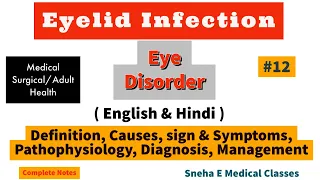 Eye lid Infection !! Hindi !! Eye disorders!!