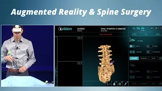 Augmented Reality and Spine Surgery | Live Demonstration with Dr. Chris Hills | St. John's Health