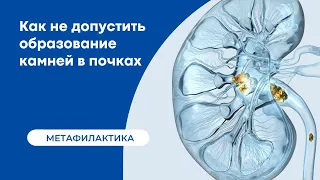 Как не допустить образование камней в почках