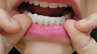 Perfect Smile Teeth SNAP ON VENEERS - Snap on teeth | EllePeri - Instant Smile Snap-On Smile Veneers