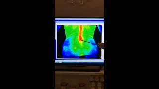 Watch a Thermography Scan