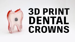 How to 3D print PFM dental crowns // Glidewell Laboratories