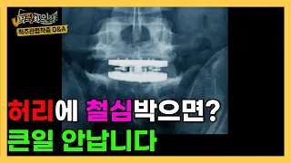 부모님의 단골 허리 질환 ‘척추관협착증’ 그 오해와 진실!! 수많은 궁금증을 속 시원하게 해결해드려요~(feat. 강태욱 원장)