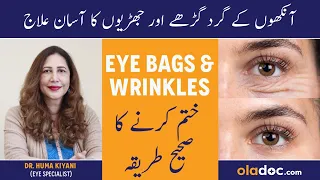 How To Remove Under Eye Wrinkles In Urdu - BOTOX & Fillers Treatment For Eye Bags - Khubsurat Ankhen