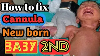 how to fix cannula 2nd #trending #new #baby #afterbirth #cutebaby #babygirl #viralvideo #viral