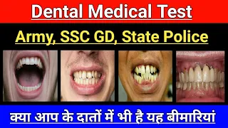 Indian Army, SSC GD, State Police ll Teeth Medical Test In Hindi ll Dental Medical Test