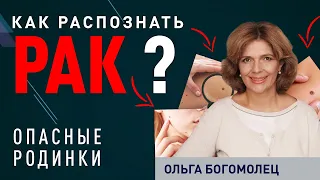 Родинки или Меланома, что надо знать? #родинки #меланома