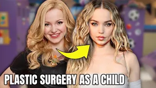 Dove Cameron's Plastic Surgery; started YOUNG