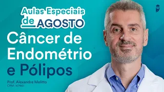 Câncer de Endométrio e Pólipos  - Revalida Exclusive - Alexandre Melitto