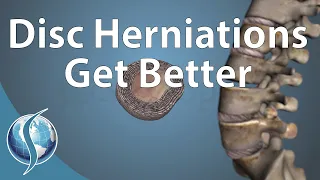 Can a Disc Herniation Heal Itself?