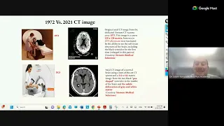 CT Spectral imaging Vs. Conventional CT