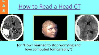 How to read CT scan Brain images in clinical?