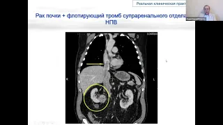 МНПК «Венозные тромбоэмболические осложнения»