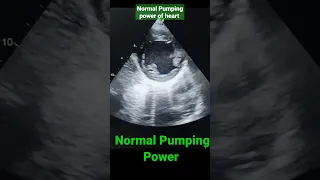 Normal Pumping power of heart in Echo (EF=55-70%) #shorts #echo
