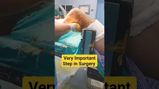 Most💯 Important Step Before any Procedure 🔥