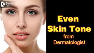 How To Get An Even Skin Tone from a dermatologist? Procedures done-Dr. Rasya Dixit | Doctors' Circle