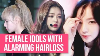 4 Female Idols Who Are Going BALD