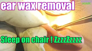 Vietnamese style earwax | super relaxing and pleasant | ear wax removal | ear wax cleaning |