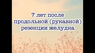 7 лет после бариатрической операции - Лапароскопическая продольная (рукавная) резекция желудка.