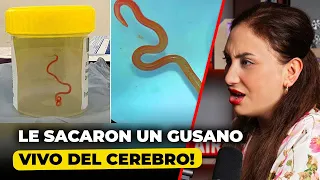 ¡Increíble! Cirujano Extrae Gusano Vivo del Cerebro de una Mujer | Alba Marina