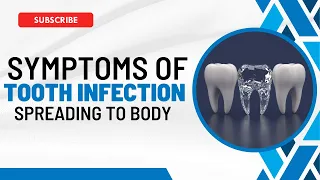 Tooth Infection Spreads: Recognizing the Symptoms and What to Do