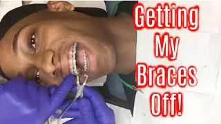 VLOG: Getting My Braces Off | DeeByDefault