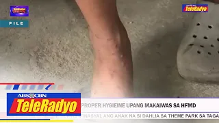 Solante: Ugaliin ang proper hygiene upang makaiwas sa HFMD | TELERADYO BALITA (9 Dec 2022)