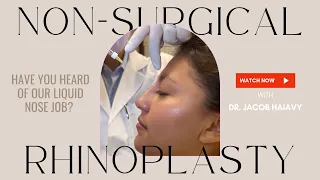 Non-Surgical Rhinoplasty AKA Liquid Nose Job