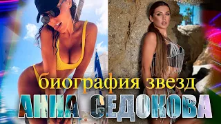 Голая Анна Седокова | Биография и откровенные фото