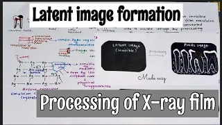 LATENT IMAGE FORMATION || INVISIBLE IMAGE || PROCESSING OF FILM || ORAL RADIOLOGY || made easy