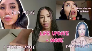 CHIN FILLER, BTS PHOTOSHOOTS, LIFE UPDATE & MORE!!