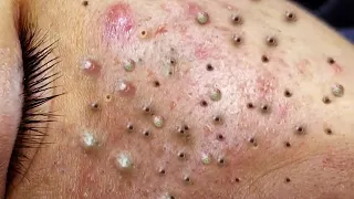 Satisfying video By Loan Nguyen Spa/Sac Dep Spa #28