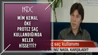 Prof. Mim Kemal Öke, HDC Protez Saç Kullandığında Neler Hissetti